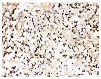 VCP Antibody