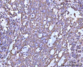 RPS14 Antibody / 40S ribosomal protein S14