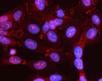 MYL5 Antibody / Myosin light chain 5