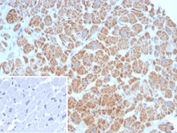 SDHA Antibody