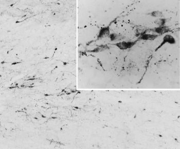 AGRP Antibody