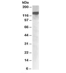 DHX9 Antibody
