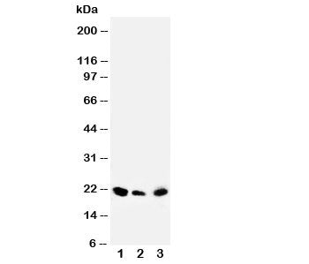 Western blot testing of DUSP3 antibody and Lane 1: rat testis; 2: human SKOV; 3: (h) MM453 cell lysa