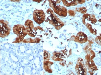 IHC staining of FFPE human kidney tissue with recombinant FABP1 antibody (clone rFABP1/8520). Inset: