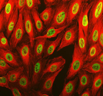 Immunofluorescent staining of THRAP3 using anti-THRAP3 antibody (green) and anti-Alpha Tubulin antib