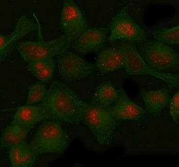 Immunofluorescent staining of FFPE human HeLa cells with SIRT1 antibody (red) and Beta Tubulin mAb (