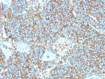 CD99 Antibody / MIC2