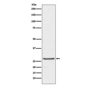 Western blot testing of human prostate cancer lysate with TIMP1 antibody. Expected molecular weight: