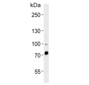 Western blot testing of human heart tissue lysate with ZNF219 antibody. Predicted molecular weight ~