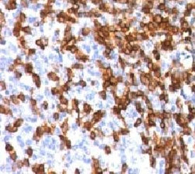 CD44 Antibody / HCAM