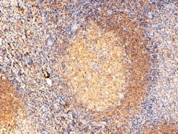 RAC2 Antibody