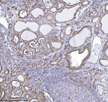 Drebrin 1 Antibody