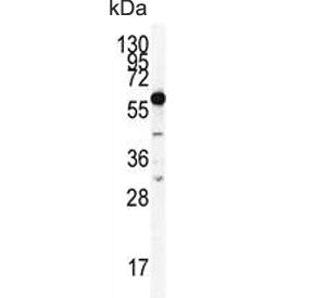 Western blot testing of human 293 cell lysate with HDAC2 antibody. Predicted molecular weight: 55-60