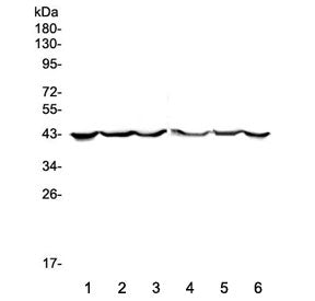 Western blot testing of human 1) placenta, 2) MCF7, 3) SW620, 4) COLO-320, 5) HepG2 and 6) PANC-1 ly