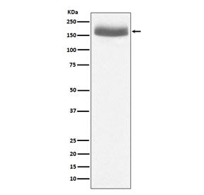Western blot testing of human urine protein lysate with EGF antibody. Predicted molecular weight: ~1