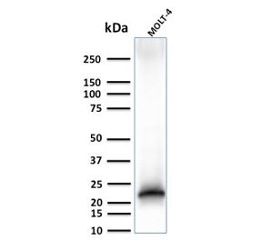 Western blot testing of human MOLT-4 cell lysate with recombinant CD3e antibody (clone C3e/3125R). P