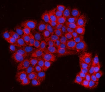 EVI1 Antibody / PRDM3 / MECOM