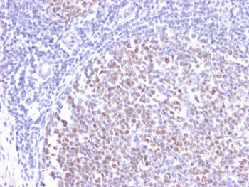 IHC staining of FFPE human tonsil with recombinant Bcl6 antibody (clone BCL6/2497R). HIER: boil tiss