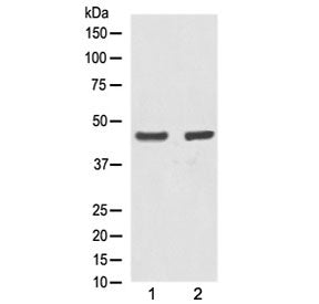 Western blot testing of human 1) A431 and 2) MCF7 lysate with Alpha Actin antibody at 0.5ug/ml. Expe