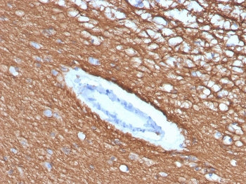 IHC staining of FFPE human cerebellum with recombinant MBP antibody (clone rMBP/4288). HIER: boil ti