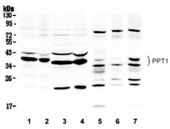 PPT1 Antibody