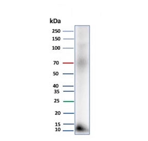 Western blot testing of human pancreas tissue lysate with Colipase antibody (clone CLPS/9027). Predi