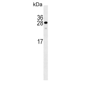Western blot testing of human WiDr cell lysate with KLF9 antibody. Expected molecular weight: 27-35 
