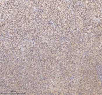 IHC analysis of SSX2IP using anti-SSX2IP antibody. SSX2IP was detected in a paraffin-embedded sectio