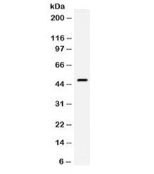 Western blot testing of mouse lung lysate with CD142 antibody. Expected molecular weight ~33/45-50 k