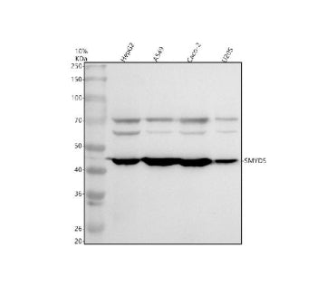 Western blot analysis of SMYD5 using anti-SMYD5 antibody. Electrophoresis was performed on a 10% SDS