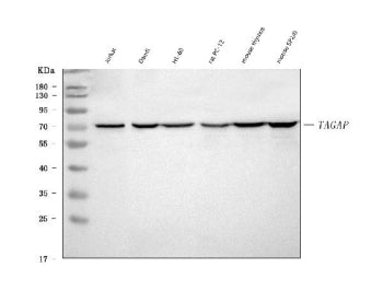 Western blot analysis of TAGAP using anti-TAGAP antibody. Lane 1: human Jurkat whole cell lysates, L