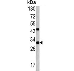 Western blot testing of mouse cerebellum lysate with ZWINT antibody. Predicted molecular weight ~31 