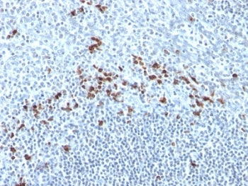 Kappa Light Chain Antibody