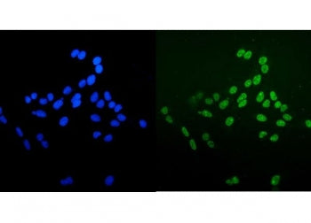 Immunofluorescent staining of FFPE human U-2 OS cells with Ku70/XRCC6 antibody (green) and DAPI nucl
