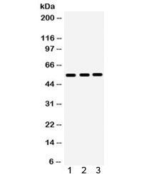 Western blot testing of 1) human placenta, 2) HeLa and 3) SGC lysate with MMP10 antibody. Expected m