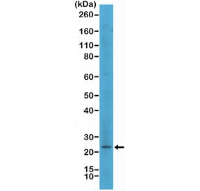 Western blot testing of human SK-MEL-2 cell lysate with recombinant MART1 antibody at 1:500. Expecte