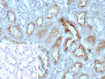 IHC staining of FFPE human kidney tissue with Nucleoside diphosphate kinase B antibody (clone NME2/1