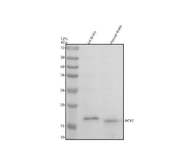 Western blot analysis of PCP2 using anti-PCP2 antibody. Electrophoresis was performed on a 12% SDS-P