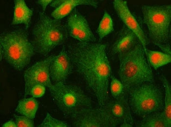 Immunofluorescent staining of FFPE human A549 cells with IFFO1 antibody (red) and Beta Tubulin mAb (