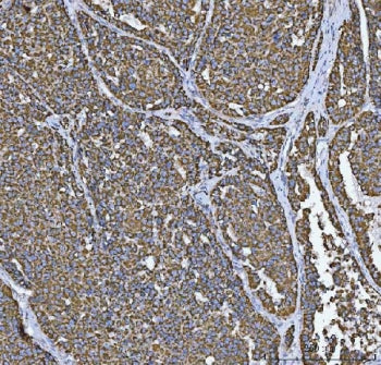 TOMM20 Antibody