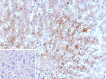 ARK1C1 Antibody / Aldo-keto Reductase Family 1 Member C1