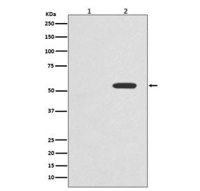 Western blot testing of lysate from 1) untreated and 2) Calyculin A and Okadaic Acid-treated human H