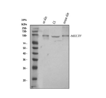 Western blot analysis of MELTF using anti-MELTF antibody. Lane 1: rat skin tissue lysates, Lane 2: r