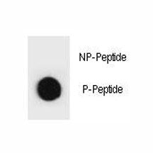 Dot blot analysis of phospho-TSC2 antibody. 50ng of phos-peptide or nonphos-peptide per dot were spo