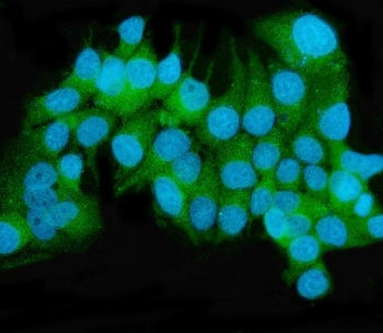 Immunofluorescent staining of FFPE human MCF7 cells with MEK2 antibody (green) and DAPI nuclear stai