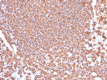 IHC testing of FFPE human tonsil tissue with recombinant CD20 antibody (clone IGEL/4524R). HIER: boi