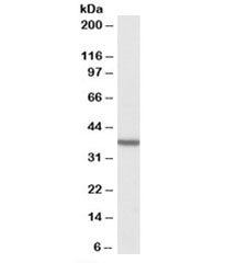 Western blot testing of human frontal cortex lysate with TOMM40 antibody at 2ug/ml. Predicted/observ