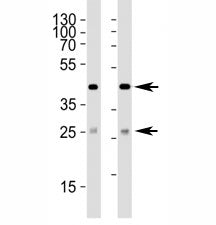 Western blot analysis of lysate from (1) 293 and (2) HepG2 cell line using SIRT3 antibody at 1:1000.
