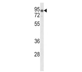 LDLR Antibody