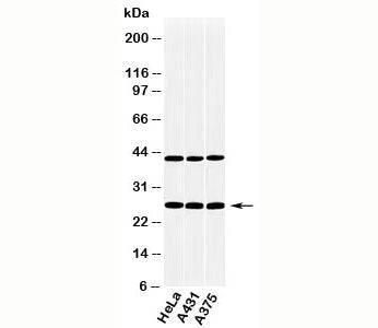 Western blot testing of human samples with CLEC4E antibody at 2ug/ml.